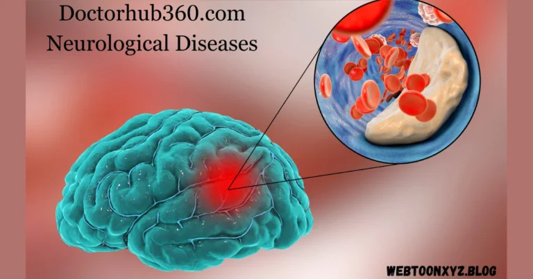 Doctorhub360.com Neurological Diseases